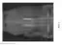 Fig. 02 - Moldable formulations containing an oxysterol in an acellular tissue matrix