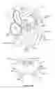 Fig. 02 - Artificial heart