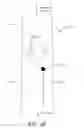 Fig. 16 - Fluid bolus detection
