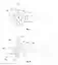 Fig. 07 - Transitional airway