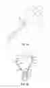 Fig. 06 - Ureteral and bladder catheters and methods of inducing negative pressure to increase renal perfusion