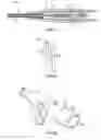 Fig. 04 - Septum securement