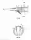 Fig. 07 - Septum securement
