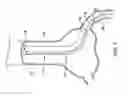 Fig. 02 - Trap balloon catheter with trap balloon retainer