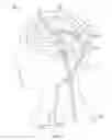 Fig. 02 - BIMODAL SHUNT