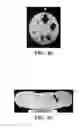 Fig. 06 - TISSUE MARKERS