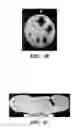 Fig. 06 - Injection applicator for tissue markers