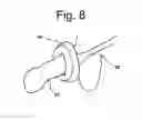 Fig. 08 - Systems and methods for the treatment of pelvic disorders including magnetic particulates