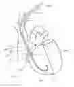 Fig. 09 - Temporary pacing lead