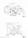 Fig. 02 - Flexible band tine array, particularly for an implantable cardiac pacemaker