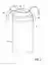 Fig. 03 - Flexible band tine array, particularly for an implantable cardiac pacemaker