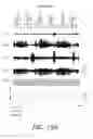 Fig. 16 - EPIDURAL STIMULATION FOR FACILITATION OF LOCOMOTION, POSTURE, VOLUNTARY MOVEMENT, AND RECOVERY OF AUTONOMIC, SEXUAL, VASOMOTOR, AND COGNITIVE FUNCTION AFTER NEUROLOGICAL INJURY