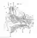 Fig. 02 - COCHLEAR IMPLANT ELECTRODE ARRAY INCLUDING RECEPTOR AND SENSOR