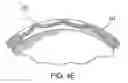 Fig. 09 - COCHLEAR IMPLANT ELECTRODE ARRAY INCLUDING RECEPTOR AND SENSOR