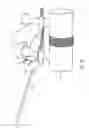 Fig. 15 - Systems and methods for restoring muscle function to the lumbar spine