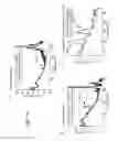 Fig. 20 - Methods and Systems for Treating Neurological Movement Disorders