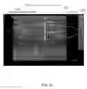 Fig. 10 - SYSTEM AND METHODS FOR FAT REDUCTION AND IMPROVING SKIN LAXITY
