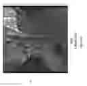 Fig. 24 - SYSTEM AND METHODS FOR FAT REDUCTION AND IMPROVING SKIN LAXITY