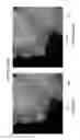 Fig. 26 - SYSTEM AND METHODS FOR FAT REDUCTION AND IMPROVING SKIN LAXITY