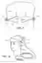 Fig. 03 - Interleaved beam pattern for sonothhrombolysis and other vascular acoustic resonator mediated therapies