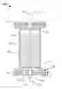 Fig. 01 - Electric Solid-liquid Separator Using Insulated Metal Beads