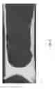 Fig. 09 - Sludge Removal Devices, Systems, and Methods