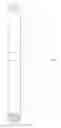 Fig. 02 - Multi-component quick assembly handle and method of making same