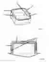 Fig. 03 - ACOUSTIC CAP WITH IMPROVED DAMPING