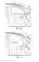 Fig. 07 - Vehicle airbag system