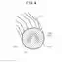 Fig. 05 - ELECTROSTATIC SENSOR