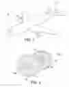 Fig. 02 - Methods for optimized engine balancing based on flight data