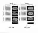 Fig. 25 - Process for the preparation of tricyclic PI3K inhibitor compounds and methods for using the same for the treatment of cancer