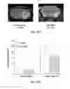 Fig. 29 - Process for the preparation of tricyclic PI3K inhibitor compounds and methods for using the same for the treatment of cancer