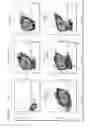 Fig. 10 - Modified chimeric receptors and related compositions and methods