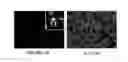 Fig. 01 - Methods to eliminate cancer stem cells by targeting CD47