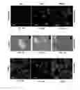 Fig. 03 - Methods to eliminate cancer stem cells by targeting CD47