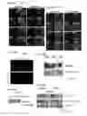 Fig. 16 - Methods to eliminate cancer stem cells by targeting CD47