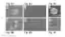 Fig. 09 - PLURIPOTENT STEM CELL THAT CAN BE ISOLATED FROM BODY TISSUE