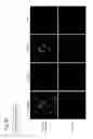 Fig. 70 - PLURIPOTENT STEM CELL THAT CAN BE ISOLATED FROM BODY TISSUE