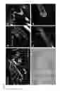 Fig. 07 - METHOD OF PRODUCING FULL THICKNESS SKIN HAVING SKIN ACCESSORY ORGANS