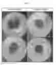 Fig. 02 - Method of promoting spheroid formation