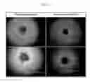 Fig. 03 - Method of promoting spheroid formation