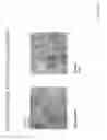 Fig. 06 - Systems and methods for growing a biofilm of probiotic bacteria on solid particles for colonization of bacteria in the gut