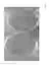 Fig. 07 - Systems and methods for growing a biofilm of probiotic bacteria on solid particles for colonization of bacteria in the gut