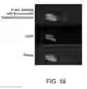 Fig. 23 - Transposition of native chromatin for personal epigenomics