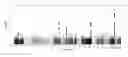 Fig. 01 - Tumor mutation burden