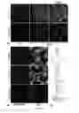 Fig. 04 - VISUAL DETECTION OF PLATINATED DNA LESIONS FROM A CLICKABLE CISPLATIN PROBE USED AS DIAGNOSTIC TOOL OR TO IDENTIFY SYNERGISTIC TREATMENTS