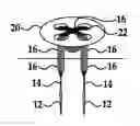 Fig. 01 - Multistrand button retention system