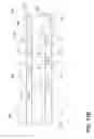 Fig. 13 - SPLINE FOR A TURBINE ENGINE