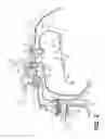 Fig. 03 - System and method for cleaning cooling passages of a combustion chamber